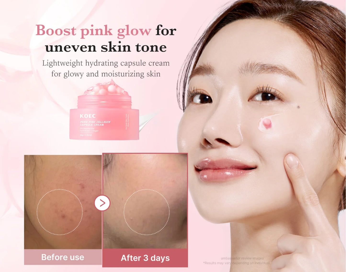 KOEC Pink Glow Bundle – Niacinamide Cream + PDRN Serum (Free Glow Getter Skincare Guide)